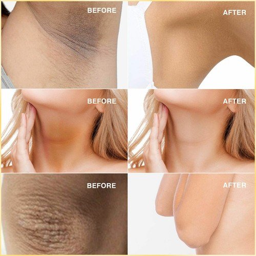 KOJIC ACID Skin Whitening Lightening Face Brightening Serum Dark Spot Cream